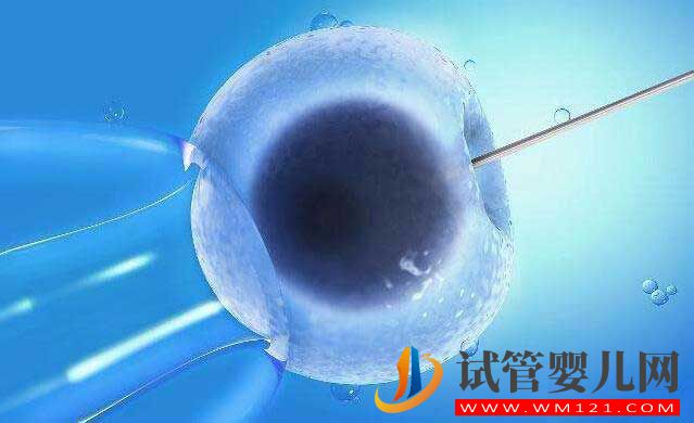做試管嬰兒整個環節有哪些?(圖1) 做試管嬰兒整個環節有哪些?(圖1)