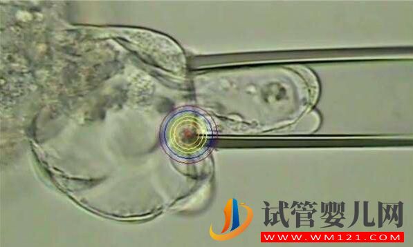 人工授精多次失敗后還可以做試管嬰兒?jiǎn)?(圖5) 人工授精多次失敗后還可以做試管嬰兒?jiǎn)?(圖5)