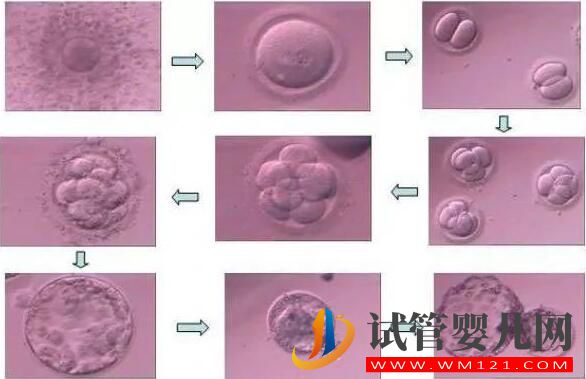 胚胎碎片率的變化對試管嬰兒意味著什么(圖2) 胚胎碎片率的變化對試管嬰兒意味著什么(圖2)