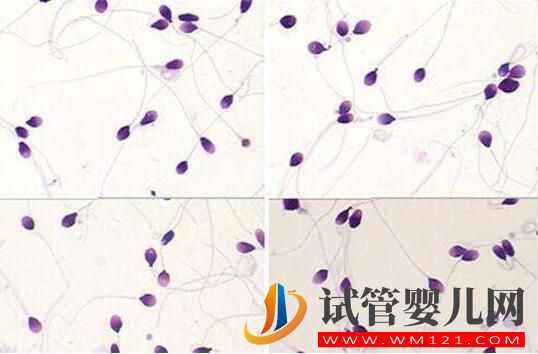 胚胎碎片率的變化對試管嬰兒意味著什么(圖4) 胚胎碎片率的變化對試管嬰兒意味著什么(圖4)