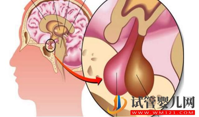 泌乳素高會(huì)影響做試管嬰兒嗎?如何比較好?(圖1) 泌乳素高會(huì)影響做試管嬰兒嗎?如何比較好?(圖1)