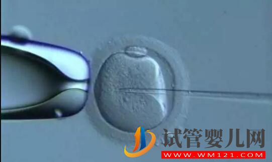 試管嬰兒做一代好還是二代好?(圖2) 試管嬰兒做一代好還是二代好?(圖2)