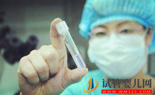 試管嬰兒對(duì)男方精子有什么要求,快來記下吧(圖2) 試管嬰兒對(duì)男方精子有什么要求,快來記下吧(圖2)