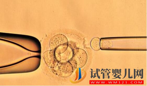 試管嬰兒為什么不能包成功?存在的原因是什么(圖4) 試管嬰兒為什么不能包成功?存在的原因是什么(圖4)