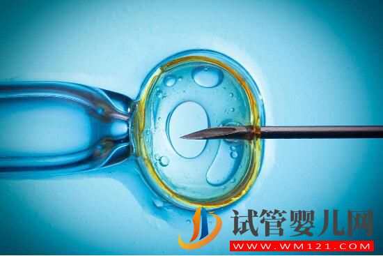 做試管嬰兒的流程有哪些 手術費用包括哪些方面(圖1) 安順做試管嬰兒的流程有哪些 手術費用包括哪些方面(圖1)