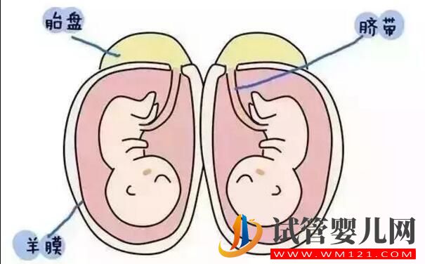 怎么樣懷雙胞胎的概率更大 有什么好的方法嗎(圖1) 怎么樣懷雙胞胎的概率更大 有什么好的方法嗎(圖1)