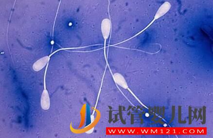 為什么試管的費(fèi)用會因人而異？如何減少做試管的花費(fèi)？(圖2)