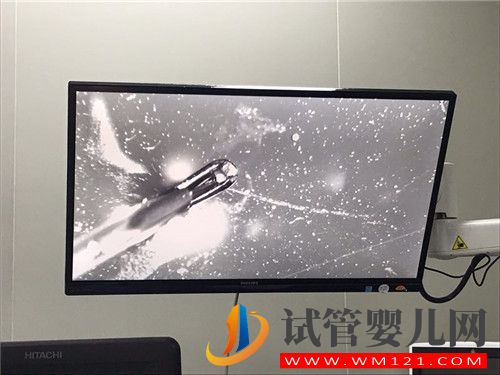 左側(cè)卵巢被割除、三次試管失敗她該怎么辦?(圖2) 左側(cè)卵巢被割除、三次試管失敗她該怎么辦?(圖2)