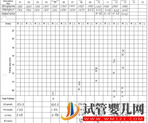 左側(cè)卵巢被割除、三次試管失敗她該怎么辦?(圖5) 左側(cè)卵巢被割除、三次試管失敗她該怎么辦?(圖5)