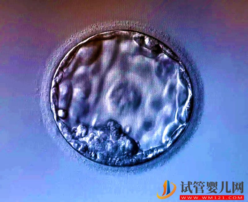 做試管養(yǎng)囊失敗的原因有哪些(圖3)