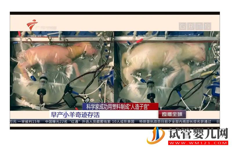 中國人造子宮生孩子需要多少錢?(圖1)