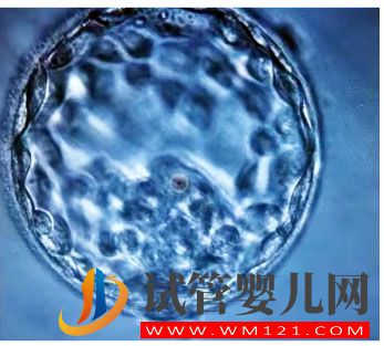 試管一次不成功做第二次費(fèi)用多少(圖1)