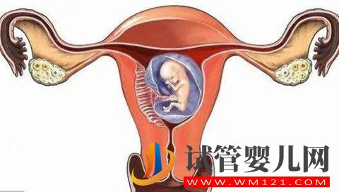 影響試管嬰兒成功率因素之的子宮內(nèi)膜容受性因素解析(圖2)