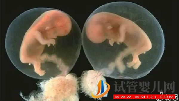 單卵雙胎發(fā)生在桑葚期是誰(shuí)的功勞？(圖1)