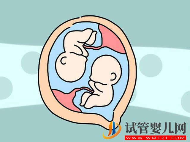 個子小的人試管適合要雙胞胎嗎？(圖1)