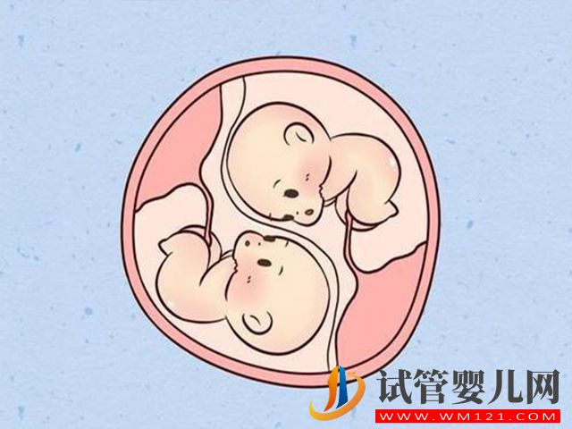 懷雙胎的孕婦會比懷單胎的血糖更高嗎？(圖1)