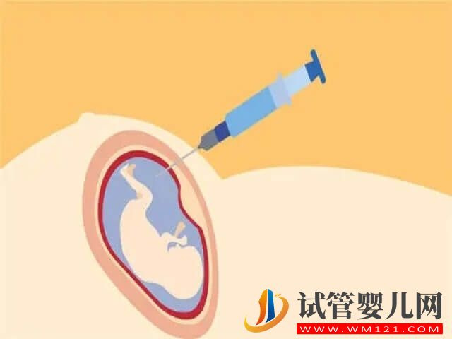 雙胞胎除了唐篩，還有哪些產(chǎn)檢做不了？(圖2)