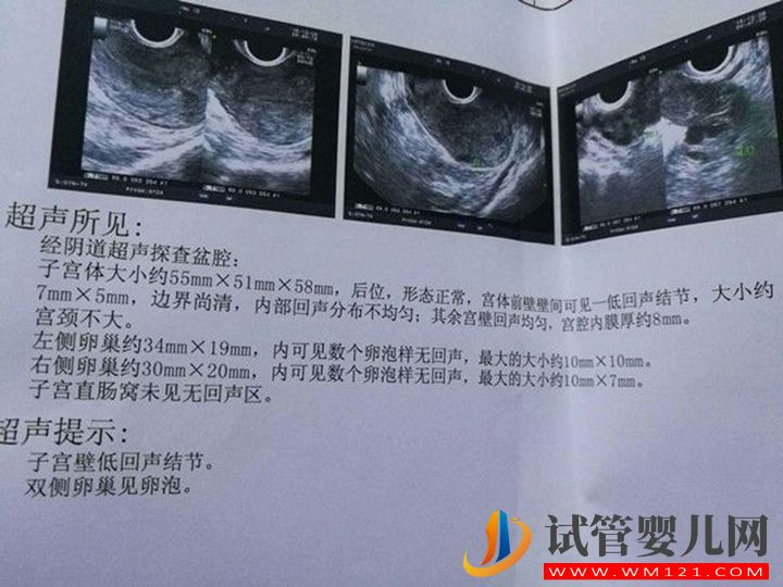 這四種癥狀需監測卵泡！監測期間需注意這些事項(圖1)