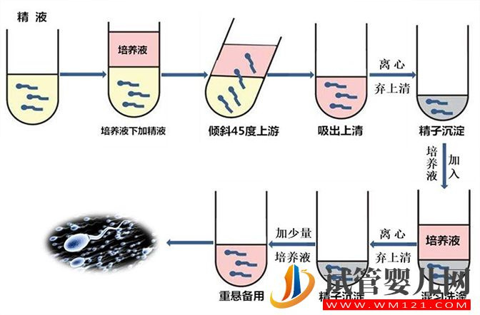 云浮男性hiv通過(guò)洗精可以生出健康的女兒?jiǎn)幔?圖2)