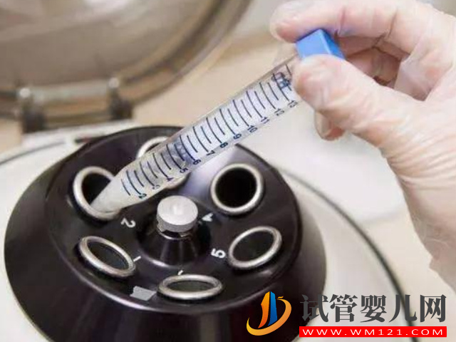 國內(nèi)男方hiv陽性洗精需要多少錢？(圖1)
