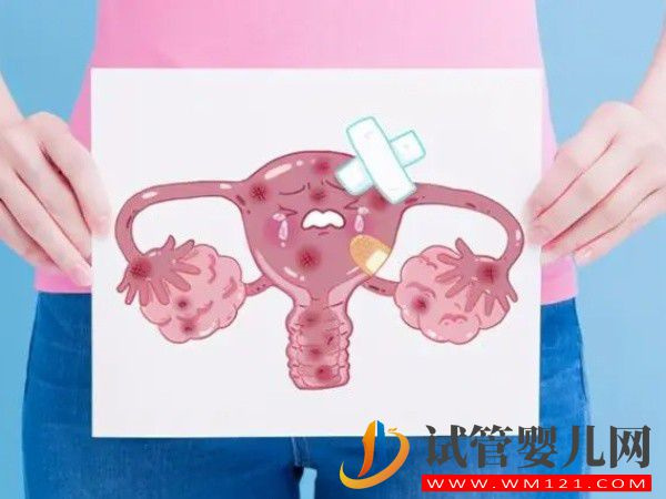 為什么很多醫生說做試管嬰兒最怕子宮內膜異位？(圖1)