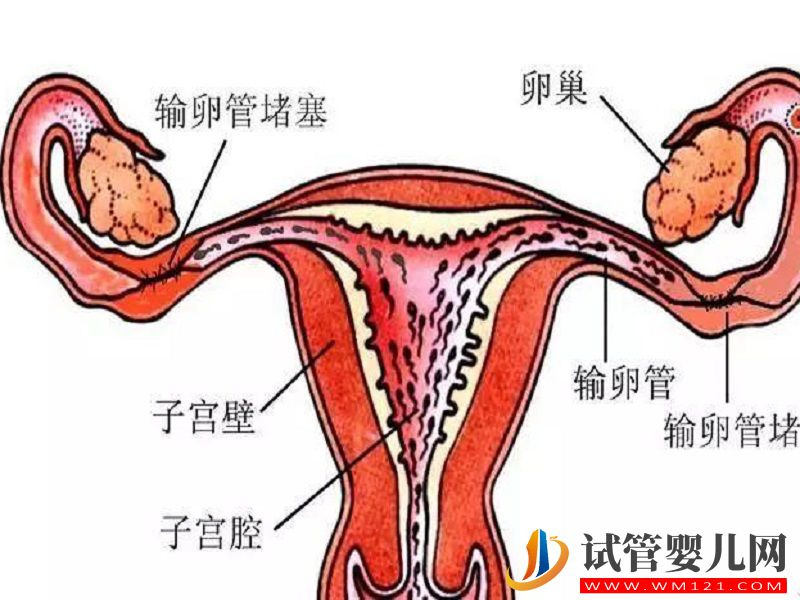 輸卵管堵塞致受孕困難很苦惱，試管嬰兒助孕當真有效？(圖1)