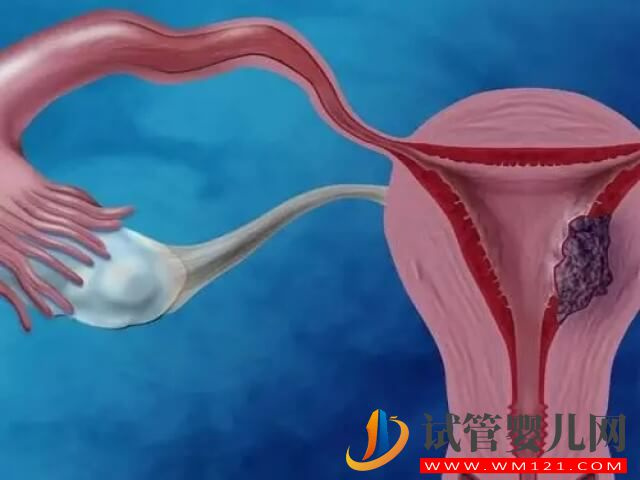 試管自然周期移植兩次囊胚都著床失敗了是什么原因？(圖2)