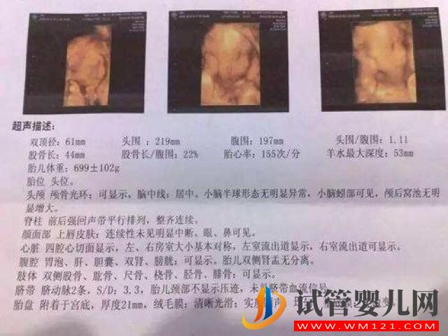 試管雙胎35周胎兒發育標準尺寸大概是多大？(圖2)