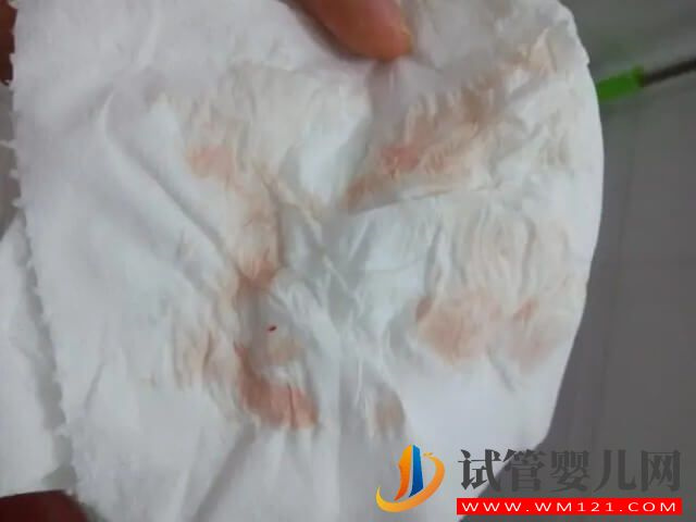 排卵期陰道少量出血會影響試管取卵么？(圖1)
