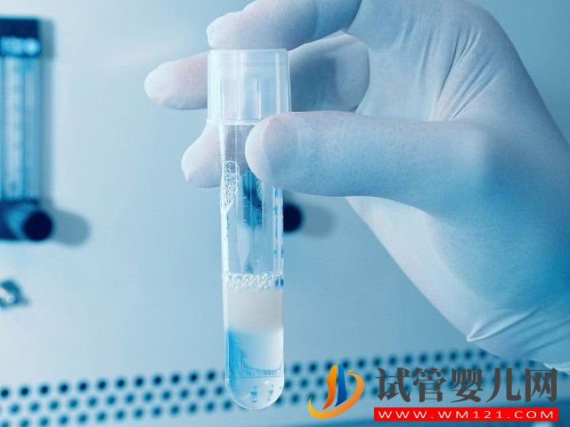 禁欲八天取出來的精子適合做試管嬰兒嗎？(圖1)