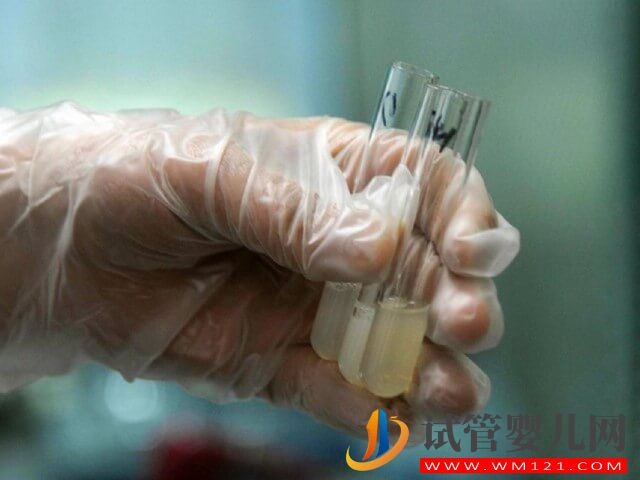 做試管精子卵子取出來后可在自然環(huán)境下放多久？(圖1)