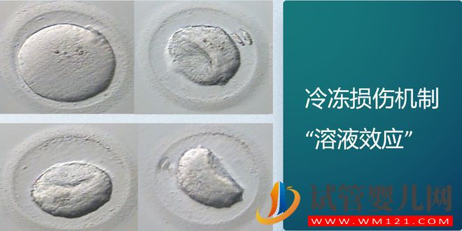 試管嬰兒技術(shù)走到了哪一步？(圖9)