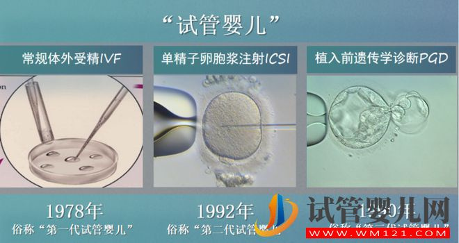 試管嬰兒技術(shù)走到了哪一步？(圖7)