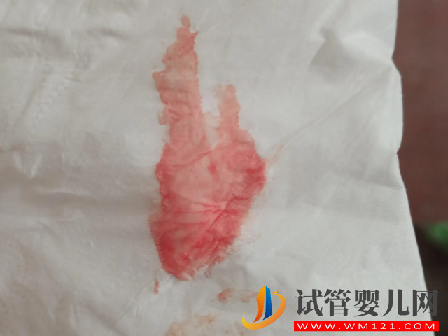 孕前一周內(nèi)懷孕身體會有癥狀，通過該表現(xiàn)還能判斷是男是女(圖3)