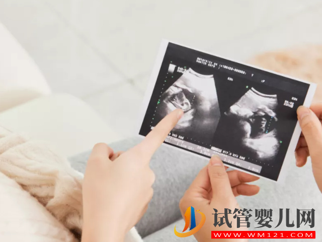 b超監(jiān)測(cè)有卵黃囊基本是宮內(nèi)妊娠，不管出現(xiàn)早晚都穩(wěn)了(圖1)