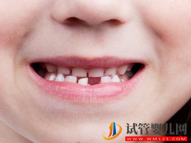 6歲兒童蛀牙洞千萬別著急補，用這招判斷說不定能省筆錢(圖1)