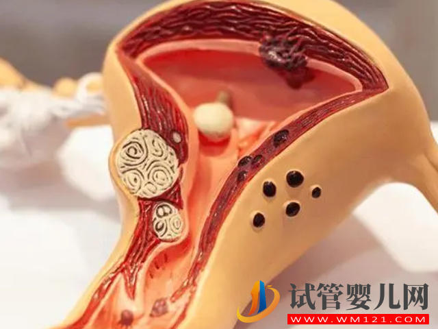 內膜薄必吃的4種促生長中藥方子分享，還您一片肥沃的土壤(圖2)