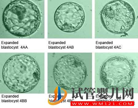 胚胎質量好,移植卻頻頻失敗 什么原因造成？(圖1)