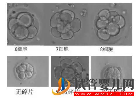 試管嬰兒多次移植不著床或生化,怎么辦(圖2)