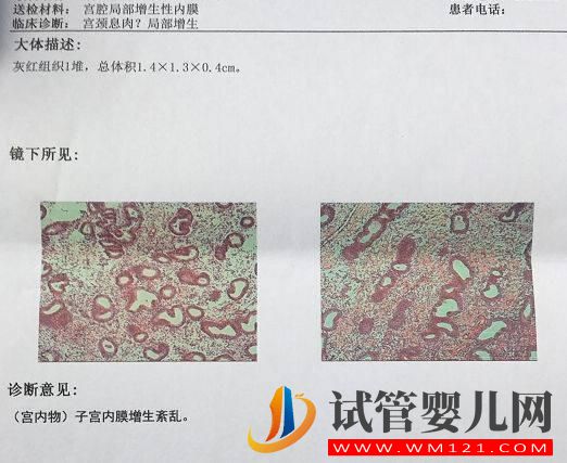 試管嬰兒多次移植不著床或生化,怎么辦(圖5)