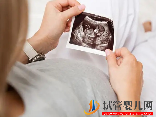 4個分辨生男女的方法超準，最早滿8周即可驗出性別(圖1)