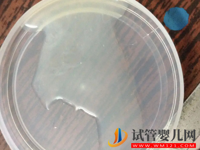 精子檢查報(bào)告單正確打開方式，看這7項(xiàng)主要數(shù)值就能知全貌(圖4)