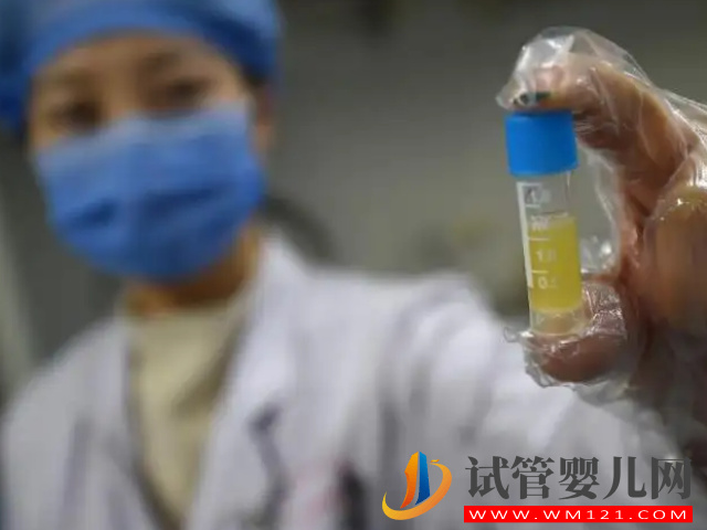 精子檢查報(bào)告單正確打開方式，看這7項(xiàng)主要數(shù)值就能知全貌(圖5)