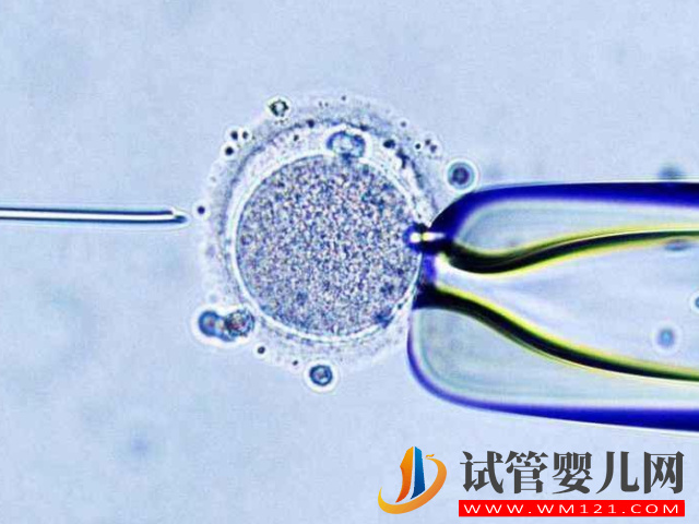不孕夫妻去香港做試管整個周期下來需要幾天？(圖1)