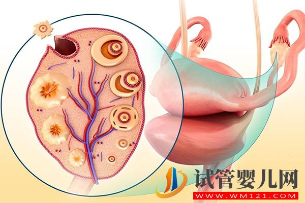 試管卵泡發育慢用短方案促排，效果不佳試試這些調理方法(圖1)