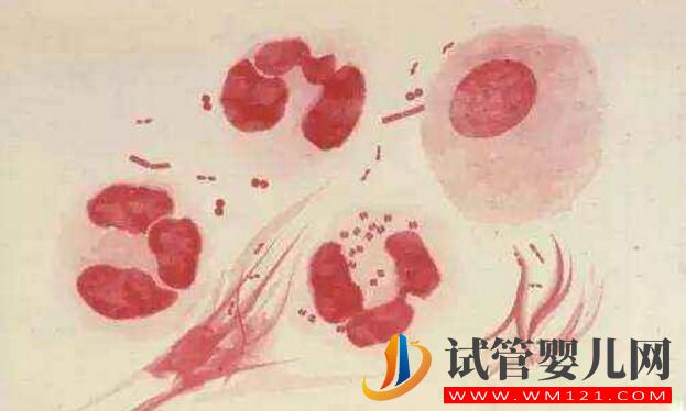 試管嬰兒前期檢查項(xiàng)目報(bào)告你看的懂嗎?看完就會了(圖5) 試管嬰兒前期檢查項(xiàng)目報(bào)告你看的懂嗎?看完就會了(圖5)