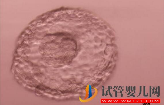 試管嬰兒養囊胚是什么樣的?什么樣的囊胚質量好?(圖2) 試管嬰兒養囊胚是什么樣的?什么樣的囊胚質量好?(圖2)