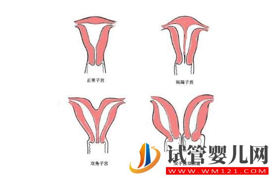 子宮偏小的女性做試管嬰兒?jiǎn)幔縼?lái)看看吧(圖1) 子宮偏小的女性做試管嬰兒?jiǎn)幔縼?lái)看看吧(圖1)