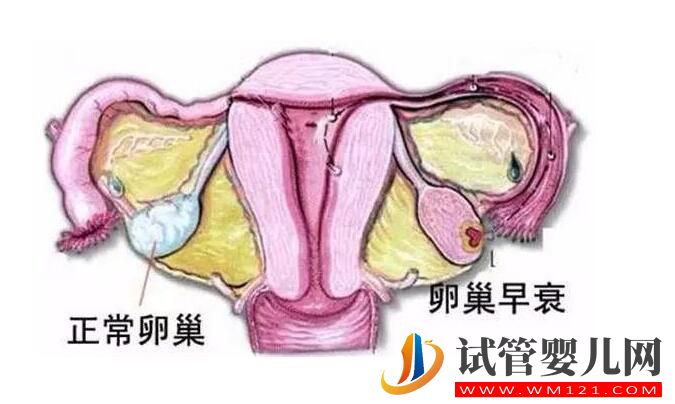 高齡女性卵巢功能低,試管手術可以做嗎(圖1) 高齡女性卵巢功能低,試管手術可以做嗎(圖1)