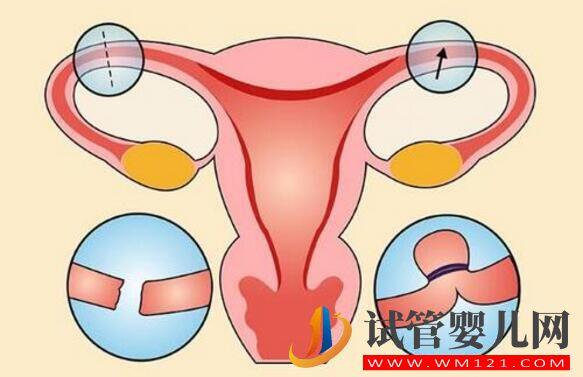 女人結(jié)扎了可以做試管嬰兒?jiǎn)幔縼?lái)看看吧(圖1) 銅仁女人結(jié)扎了可以做試管嬰兒?jiǎn)幔縼?lái)看看吧(圖1)